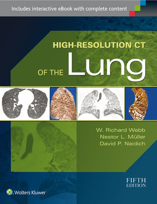 Book cover of High-Resolution Ct Of The Lung by W. Richard Webb, Nestor L. Muller, David P Naidich