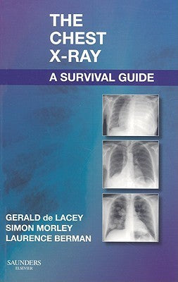 Book cover of The Chest X-Ray: A Survival Guide by Gerald de Lacey, Simon Morley, Laurence Berman