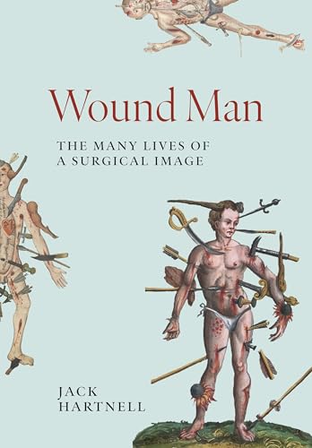 Book cover of Wound Man: The Many Lives of a Surgical Image by Jack Hartnell