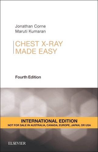 Book cover of Chest X-Ray Made Easy by Jonathan Corne, Maruti Kumaran