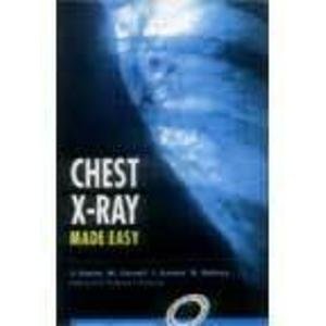 Book cover of Chest X-Ray Made Easy by John Moxham (Foreword)