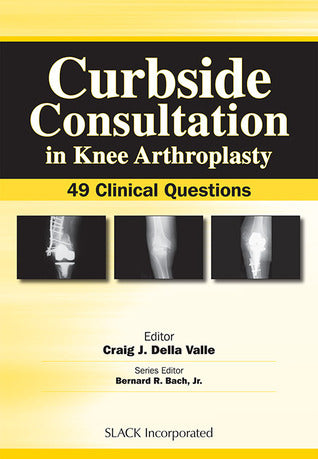 Book cover of Curbside Consultation In Knee Arthroplasty: 49 Clinical Questions by Craig Della Valle (Ed.)